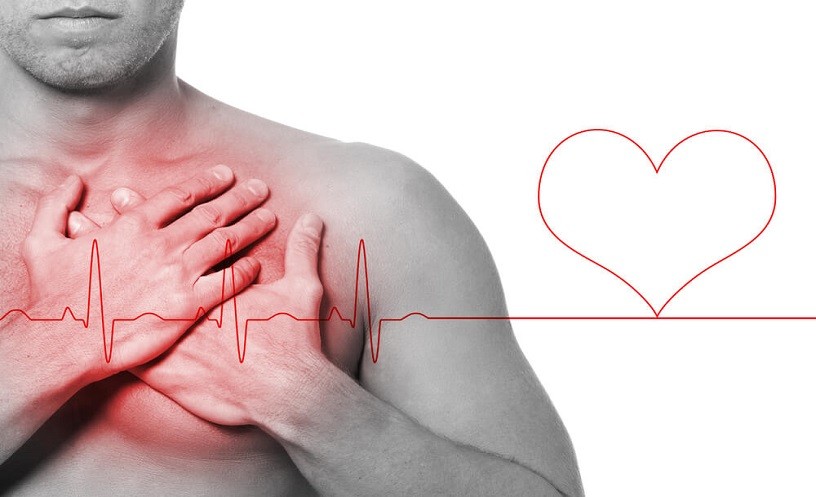 2019108_infarto.semana